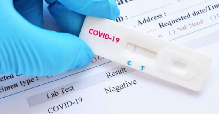 COvid 19 test